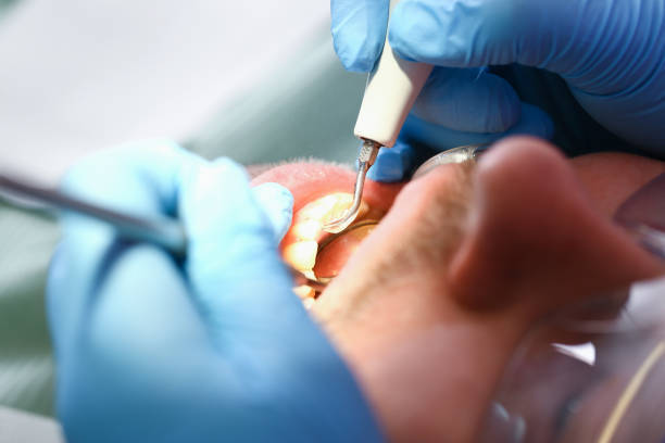 Best Orthodontic Emergency Dentist in Milton, FL