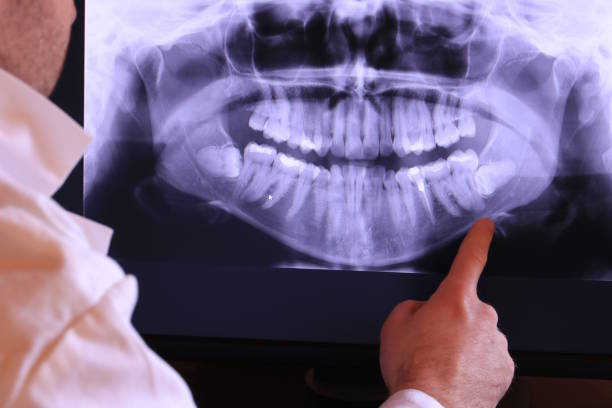 Best Emergency Dentist for Knocked-Out Tooth in Milton, FL
