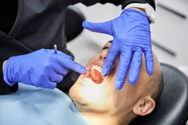 Best Broken or Cracked Tooth Emergency Dentist in Milton, FL